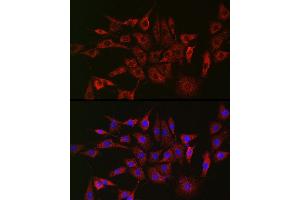 Immunofluorescence analysis of NIH/3T3 cells using GLB1 Rabbit pAb (ABIN3015642, ABIN3015643, ABIN3015644 and ABIN6218995) at dilution of 1:150 (40x lens).