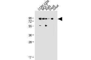 All lanes : Anti-MDM2 Antibody (C-term) at 1:1000 dilution Lane 1: CCRF-CEM whole cell lysate Lane 2: MCF-7 whole cell lysate Lane 3: A549 whole cell lysate Lane 4: Daudi whole cell lysate Lane 5: Jurkat whole cell lysate Lysates/proteins at 20 μg per lane. (MDM2 anticorps  (C-Term))