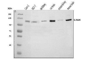 Western blot analysis of CASK using anti-CASK antibody (ABIN7601021).