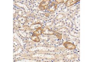 Immunohistochemistry of paraffin embedded mouse kidney using MRPS35 (ABIN7074655) at dilution of 1: 400 (300x lens) (MRPS35 anticorps)