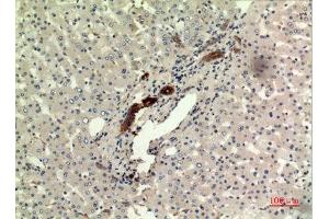 Immunohistochemistry (IHC) analysis of paraffin-embedded Human Liver, antibody was diluted at 1:100. (IFN omega (C-Term) anticorps)
