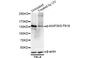 Western blot analysis of extracts of HeLa cells, using Phospho-MAP3K5-T918 antibody. (ASK1 anticorps  (pThr918))