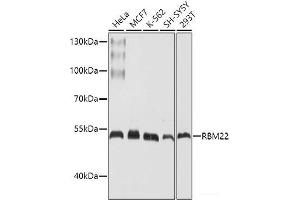 Western blot analysis of extracts of various cell lines using RBM22 Polyclonal Antibody at dilution of 1:1000. (RBM22 anticorps)