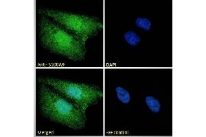ABIN335161 Immunofluorescence analysis of paraformaldehyde fixed U2OS cells, permeabilized with 0.