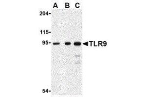 Western Blotting (WB) image for anti-Toll-Like Receptor 9 (TLR9) (Center) antibody (ABIN2479768) (TLR9 anticorps  (Center))