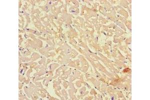 Immunohistochemistry of paraffin-embedded human heart tissue using ABIN7157632 at dilution of 1:100 (KIF24 anticorps  (AA 1168-1368))