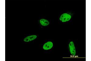 Immunofluorescence of monoclonal antibody to HEYL on HeLa cell. (HEYL anticorps  (AA 221-327))