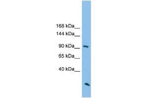 WB Suggested Anti-ARHGAP30 Antibody Titration: 0. (ARHGAP30 anticorps  (N-Term))