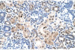 Human kidney (SLC25A45 anticorps  (C-Term))