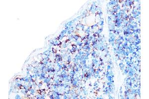 Immunohistochemistry of paraffin-embedded mouse spleen using Arp3 Rabbit mAb (ABIN7265676) at dilution of 1:100 (40x lens). (ACTR3 anticorps)