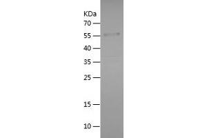 Western Blotting (WB) image for Tumor Necrosis Factor Receptor Superfamily, Member 8 (TNFRSF8) (AA 303-571) protein (His-IF2DI Tag) (ABIN7125555)