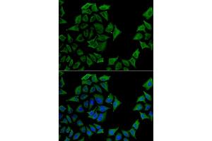 Immunofluorescence analysis of U2OS cell using TCN1 antibody. (TCN1 anticorps)