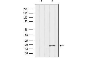 anti-Phosphatidylinositol Glycan Anchor Biosynthesis, Class P (PIGP) antibody