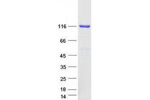Validation with Western Blot