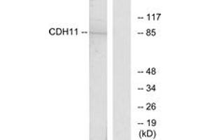 Western blot analysis of extracts from Jurkat cells, using CDH11 Antibody. (OB Cadherin anticorps  (AA 421-470))