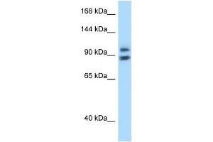 WB Suggested Anti-ZHX1 Antibody Titration: 1. (ZHX1 anticorps  (N-Term))