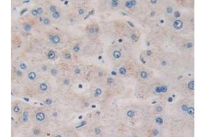 Detection of DDX58 in Human Liver Tissue using Polyclonal Antibody to Probable ATP-dependent RNA Helicase DDX58 (DDX58) (DDX58 anticorps  (AA 550-776))