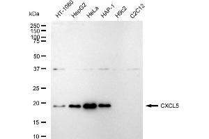 Western blotting analysis using CXCL5 antibody (ABIN7798045).