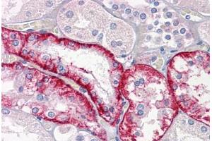 anti-Cathepsin K (CTSK) (AA 220-331) antibody