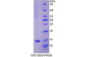 SDS-PAGE of Protein Standard from the Kit (Highly purified E. (PF4 Kit CLIA)