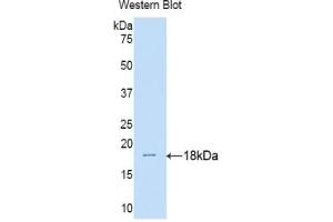 Western blot analysis of the recombinant protein. (IL17RA anticorps  (AA 33-172))