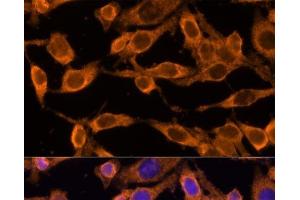 Immunofluorescence analysis of HeLa cells using USP36 Polyclonal Antibody at dilution of 1:100 (40x lens). (USP36 anticorps)