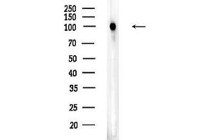 Western blot analysis of lysates from HUVEC cells, using HACE1 Antibody at 1/1000 dilution.