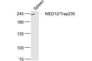 Mouse spleen lysates probed with MED12/Trap230 Polyclonal Antibody, Unconjugated  at 1:300 dilution and 4˚C overnight incubation. (MED12 anticorps  (AA 251-350))