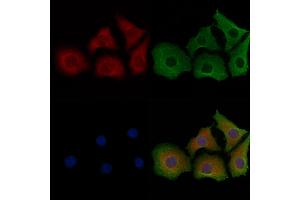 ABIN6261881, ABIN6267053, ABIN6267054 and ABIN6267055 staining Hela cells by IF/ICC.