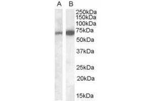 Western Blotting (WB) image for anti-Eukaryotic Elongation Factor, Selenocysteine-tRNA-Specific (EEFSEC) (C-Term) antibody (ABIN2790209)