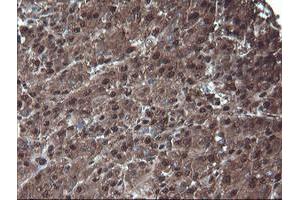 Image no. 8 for anti-Proteasome Subunit alpha 6 (PSMA6) antibody (ABIN1500465)