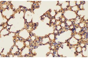 Immunohistochemistry of paraffin-embedded Mouse lung using ANXA5 Ployclonal Antibody at dilution of 1:100.