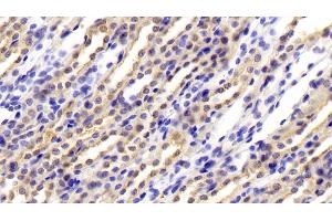 Detection of CFB in Rat Kidney Tissue using Polyclonal Antibody to Complement Factor B (CFB) (Complement Factor B anticorps  (AA 34-159))