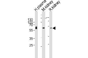 Western blot analysis of lysates from human plasma, mouse kidney, rat kidney tissue lysate (from left to right), using CNDP1 Antibody (Center) (ABIN6243352 and ABIN6577403).