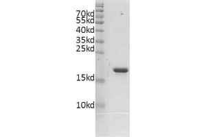 Recombinant BRD4 (333-460) protein gel. (BRD4 Protein (AA 333-460) (His tag,DYKDDDDK Tag))