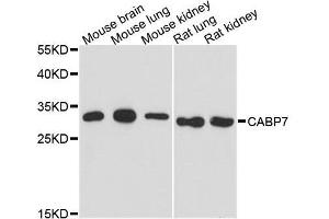 Western blot analysis of extracts of various cell lines, using CABP7 antibody. (CABP7 anticorps  (AA 100-180))