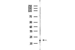Western blot analysis of lysates from Mouse liver, using CDO1 Antibody at 1/1000 dilution.