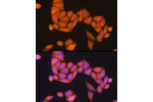 Immunofluorescence analysis of HeLa cells using Rap1B Rabbit pAb (ABIN6132985, ABIN6146685, ABIN6146686 and ABIN6216738) at dilution of 1:100 (40x lens). (RAP1B anticorps  (AA 1-184))
