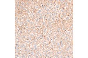 Immunohistochemistry of paraffin-embedded mouse liver using CDH18 antibody (ABIN6291131) at dilution of 1:100 (40x lens). (CDH18 anticorps)