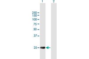 Western Blot analysis of TERF2 expression in transfected 293T cell line by TERF2 MaxPab polyclonal antibody. (TRF2 anticorps  (AA 1-251))
