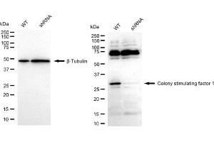 Western blotting analysis using Colony stimulating factor 1 antibody (ABIN7798130).