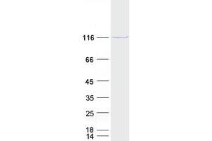 Matrin 3 (MATR3) (Transcript Variant 2) protein (Myc-DYKDDDDK Tag)
