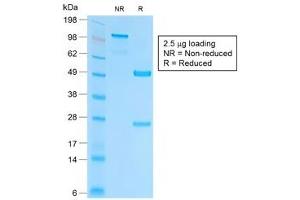 SDS-PAGE analysis of purified, BSA-free recombinant EpCAM antibody (clone EGP40/2041R) as confirmation of integrity and purity.