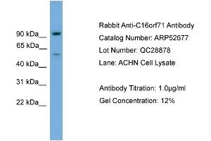 WB Suggested Anti-C16orf71  Antibody Titration: 0. (C16ORF71 anticorps  (Middle Region))