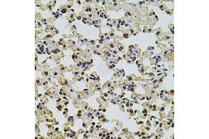 Immunohistochemistry of paraffin-embedded mouse lung using POT1 antibody. (POT1 anticorps)