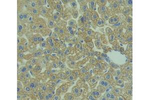 Used in DAB staining on fromalin fixed paraffin- embedded liver tissue (IL1RAP anticorps  (AA 21-367))