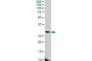 EIF4E2 monoclonal antibody (M01), clone 4G10 Western Blot analysis of EIF4E2 expression in HeLa .