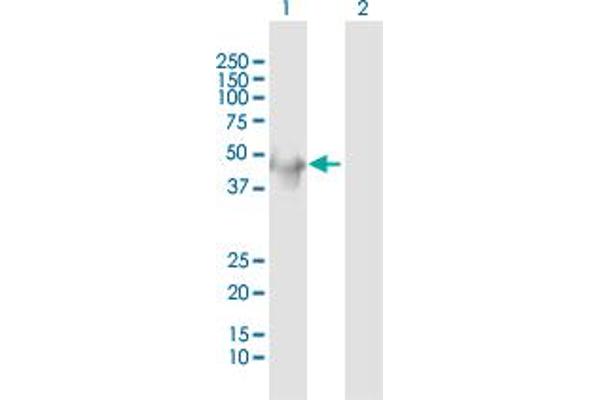 Keratin 34 anticorps  (AA 1-436)