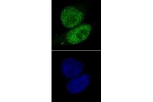 SMARCA4 antibody (mAb) (Clone 5B7) tested by immunofluorescence. (SMARCA4 anticorps  (AA 213-295))