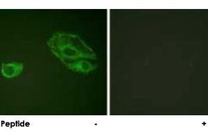 Immunofluorescence analysis of A-549 cells, using ERBB3 polyclonal antibody . (ERBB3 anticorps)